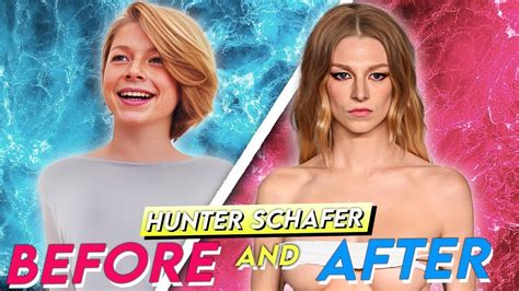 Hunter Schafer’s Breast Implants Before And After